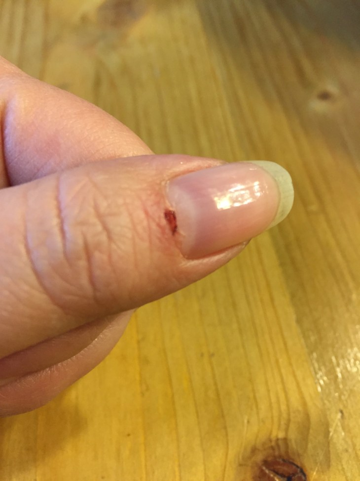 01ff111f4c4e54e85d886863e2fa08514317ccd282